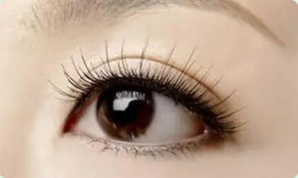 没有多余皮肤可用 开眼角需格外慎重