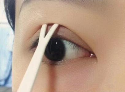 开眼角手术有没有风险？