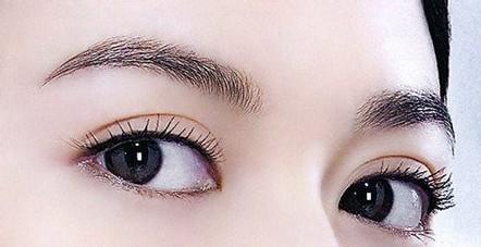 开眼角手术的过程是怎样的？