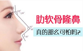 肋软骨隆鼻,真的那么可怕吗?