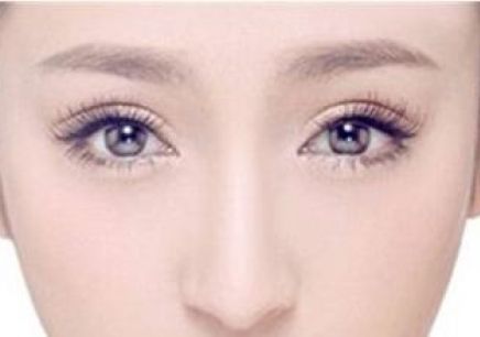 开内眼角手术后护理工作，眼部整形专家，开眼角整形手术，开内眼角术后怎么保护，