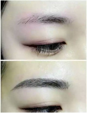 纹眉后多久才可以洗脸,纹眉手术,纹眉的效果,纹眉的方式,纹眉方法