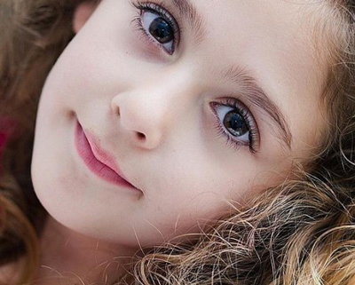 切开双眼皮，双眼皮切开法手术，切开双眼皮修复手术，双眼皮效果，