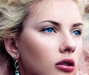 埋线双眼皮效果，双眼皮不对称，双眼皮修整，眼部修复方法，