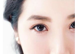 吸脂祛眼袋后效果怎么样