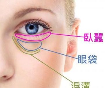 眼睛卧蚕和眼袋的区别,眼袋和卧蚕眼的区别,眼睛眼袋和卧蚕眼的区别是什么