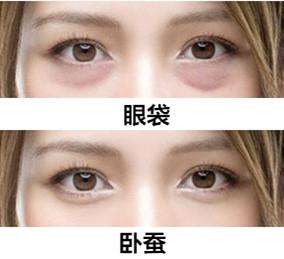 眼袋和卧蚕的区别