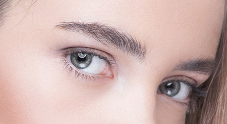 激光去眼袋美容的效果