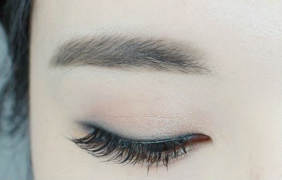 提眉术的优势有哪些