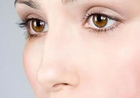 全切双眼皮手术后的护理