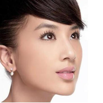 切开双眼皮和埋线双眼皮,