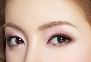 韩式开眼角的好处