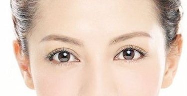 泉州做高分子埋线双眼皮