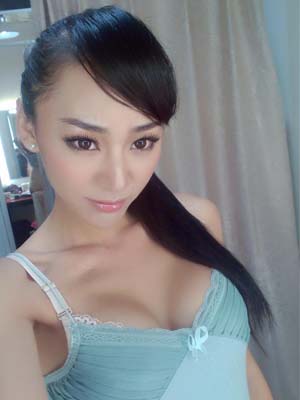 上眼睑下垂矫正方法