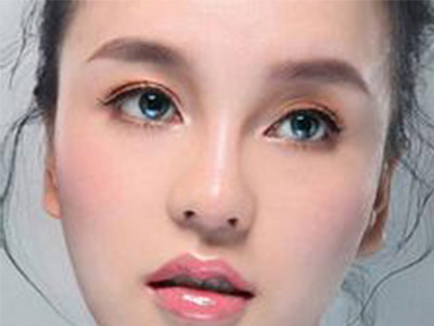 眼角手术后应该注意哪些