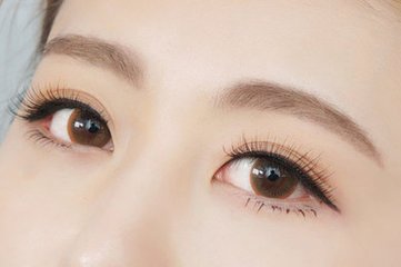 去眼袋手术方法