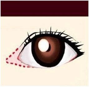 开眼角和双眼皮有什么关系？“邻居”而已！