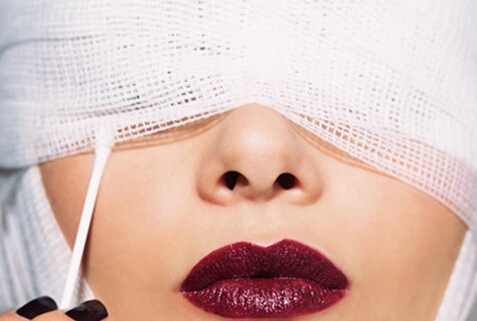 双眼皮埋线几天消肿？