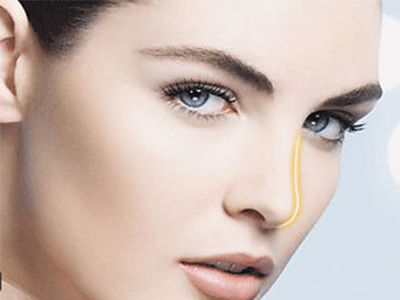 埋线双眼皮的坏处