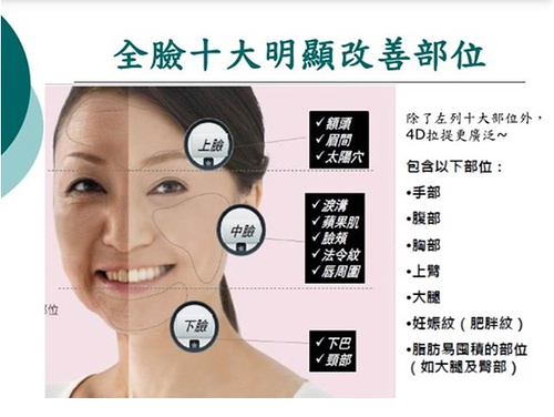 埋线提拉的适应症