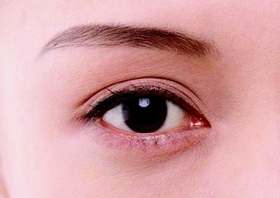 割韩式双眼皮多少钱