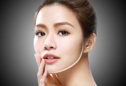 做面部蛋白埋线提升多少钱