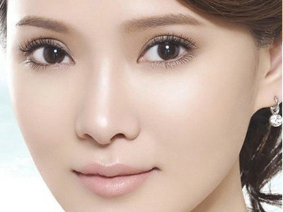 开内眼角手术需要多久恢复