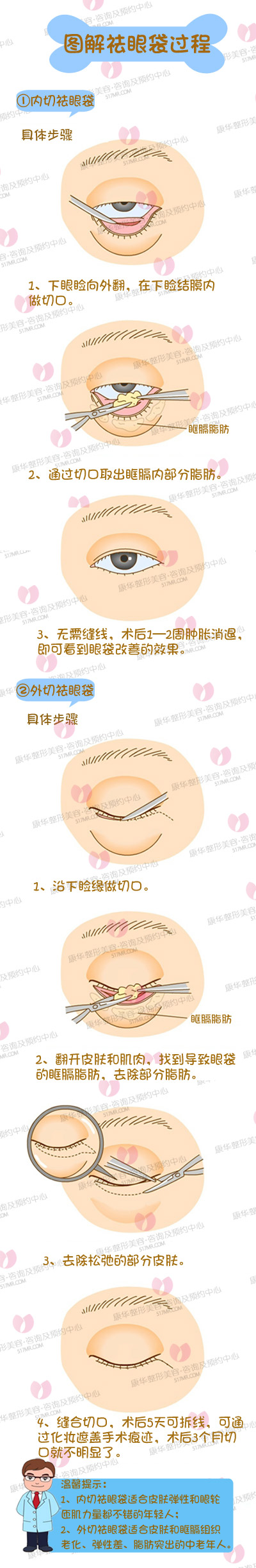 图解祛眼袋过程