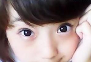 埋线做双眼皮多少钱