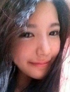 “涵山涵瑶凌瑶”双眼皮手术后样子