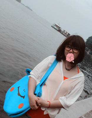 我的埋线双眼皮恢复日记 大家看看肿么样！