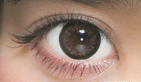 韩式双眼皮埋线术