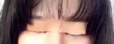 开眼角加双眼皮后 我变身萌妹纸一枚!