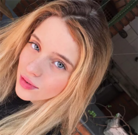 开眼角多长时间可以做美瞳线，开眼角的恢复时间，开眼角手术，开眼角的价格，开眼角的效果，