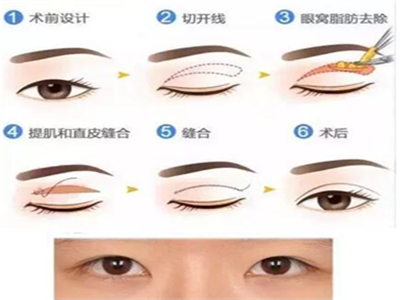 “东方眼”应该如何改善