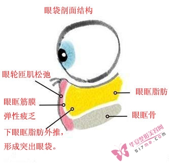 眼袋剖面结构