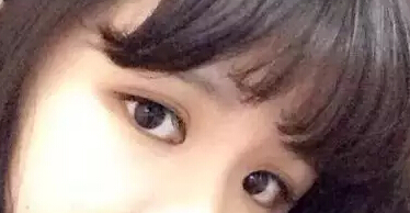 开眼角加双眼皮后 我变身萌妹纸一枚!