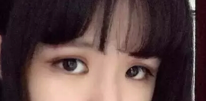 开眼角加双眼皮后 我变身萌妹纸一枚!