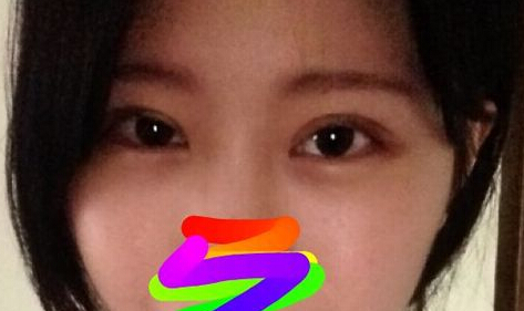 妹子分享：看我的韩式双眼皮前后对比如何？