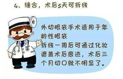 想要去眼袋？先了解眼袋整形术过程！