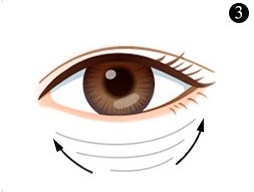 不开刀溶脂去眼袋多少钱