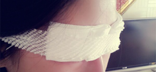 妹子分享切开双眼皮消肿妙招：敷土豆片！