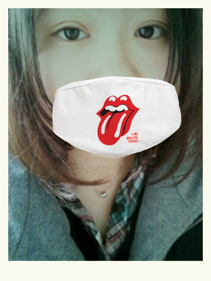 我的埋线双眼皮恢复日记 大家看看肿么样！