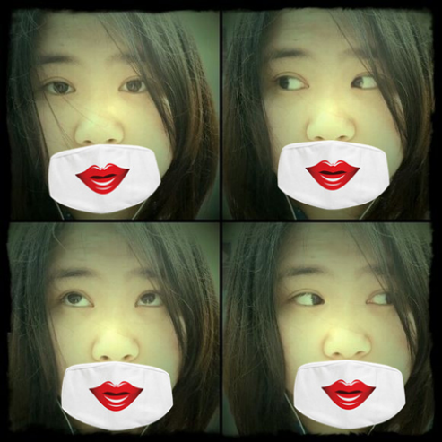 我的埋线双眼皮恢复日记 大家看看肿么样！