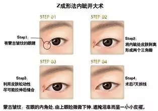 开眼角是什么样子？上图告诉你