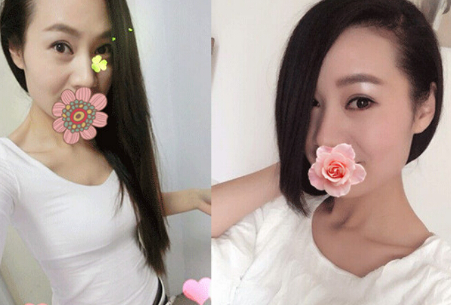 全切双眼皮加开内眼角后 我的整个气质up！