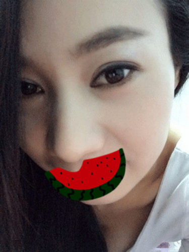 全切双眼皮加开内眼角后 我的整个气质up！