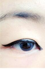 怎么不动手术开眼角