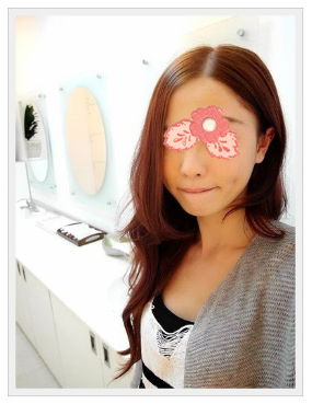 案例：埋线提拉一做 大小脸不见了！