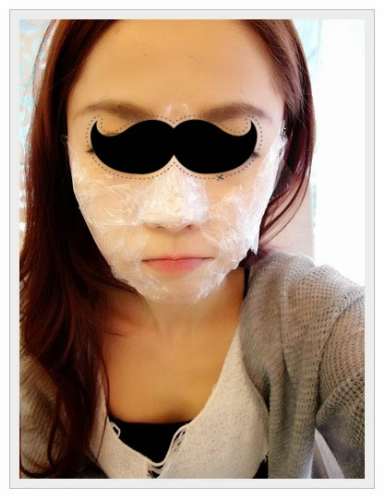 案例：埋线提拉一做 大小脸不见了！